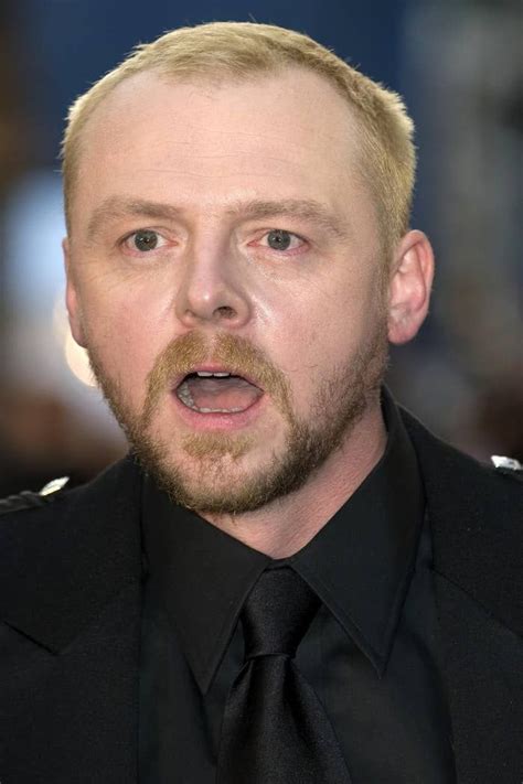 dan reynolds hair transplant|42 Celebrity Men Who Are Less Bald Than They Used To Be .